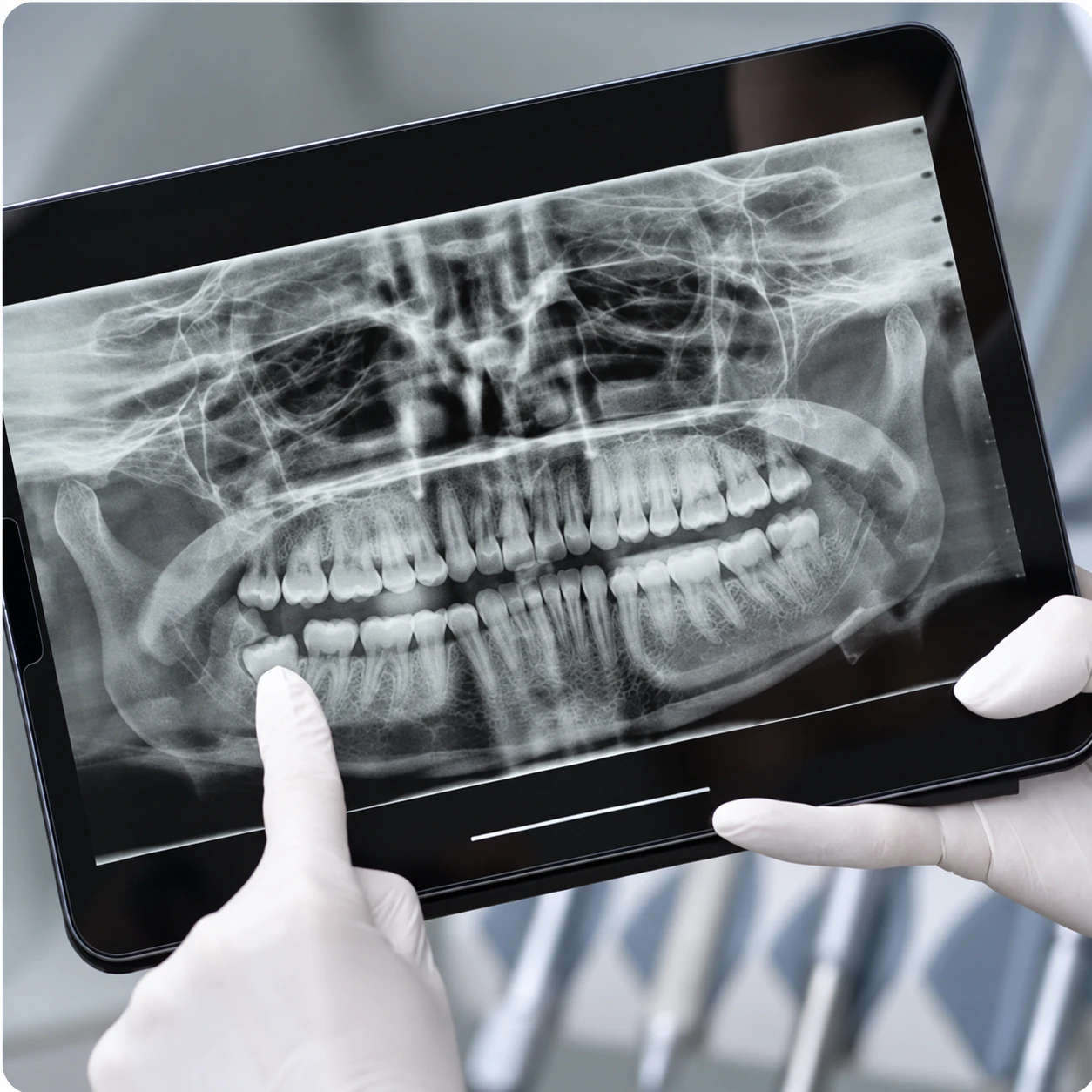 Exam & X-Ray